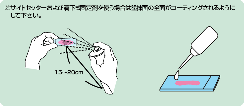 2. サイトセッターおよび滴下式固定剤を使う場合は塗抹面の全面がコーティングされるようにしてください。