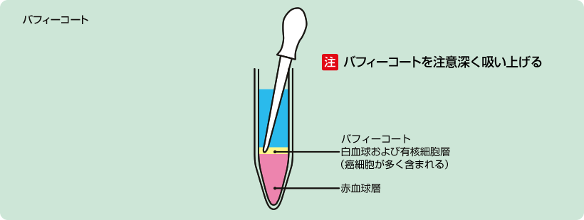 バフィーコート：図　注意　上層部を注意深く吸い上げる